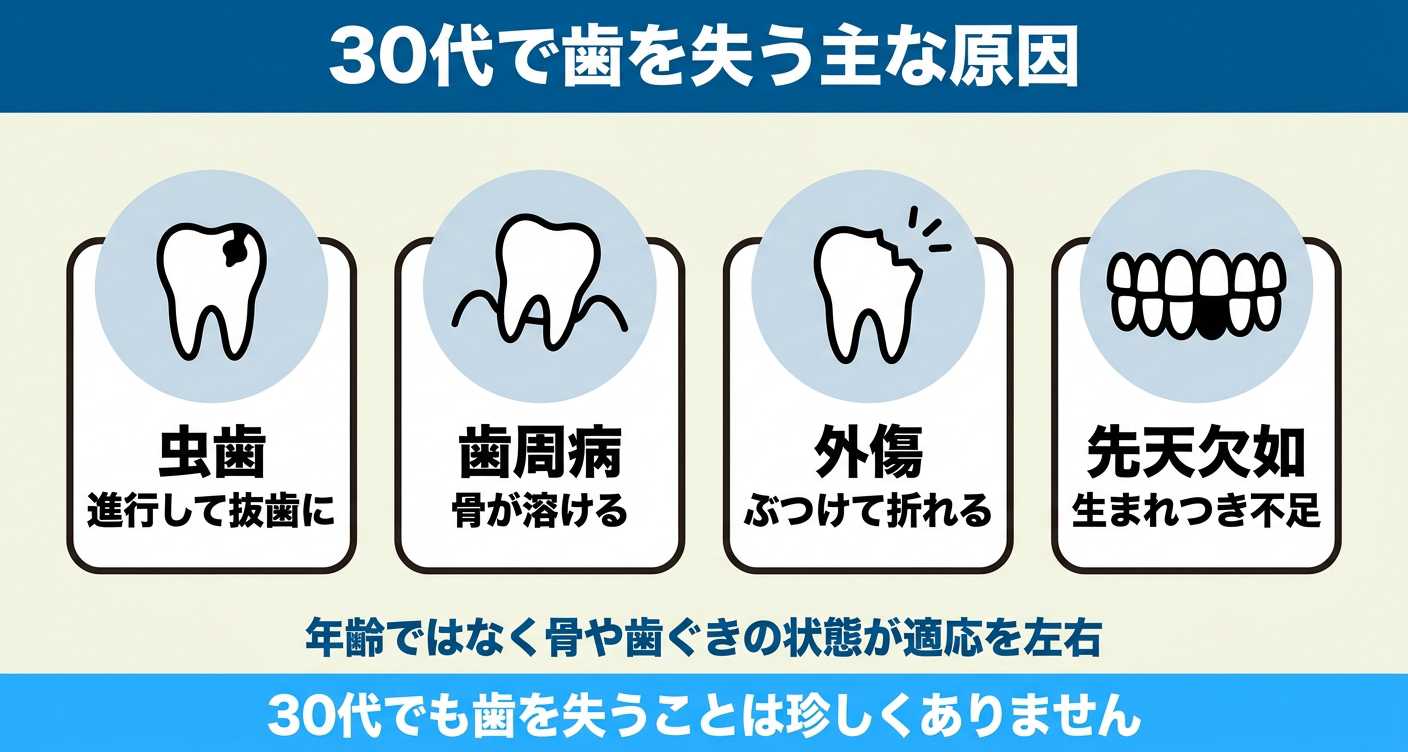 30代で歯を失う主な原因を4つのカードで示した図解