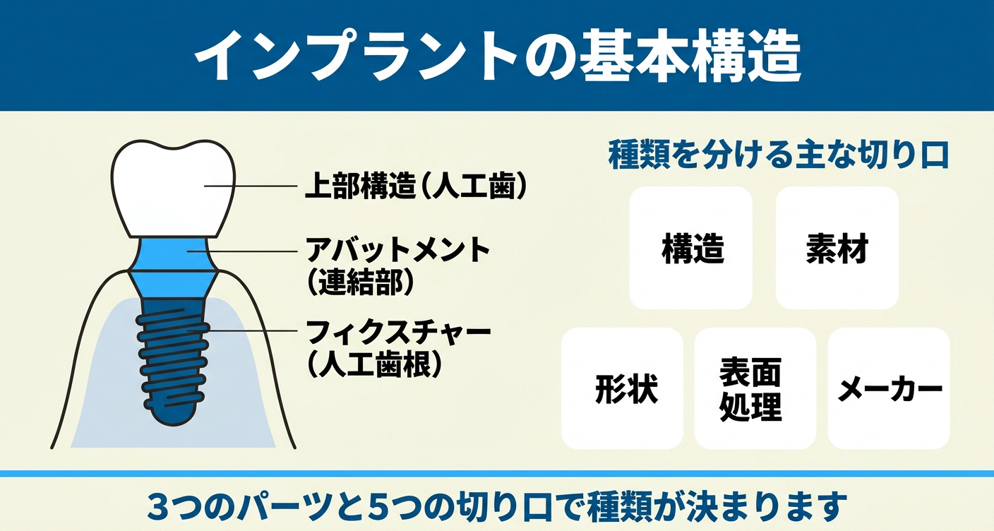 インプラントの基本構造と種類の全体像を示した図解。