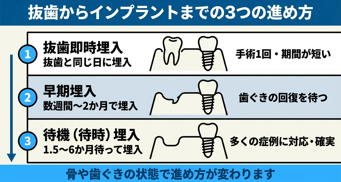 抜歯からインプラントまでの進め方を即時・早期・待機で比較した図解。