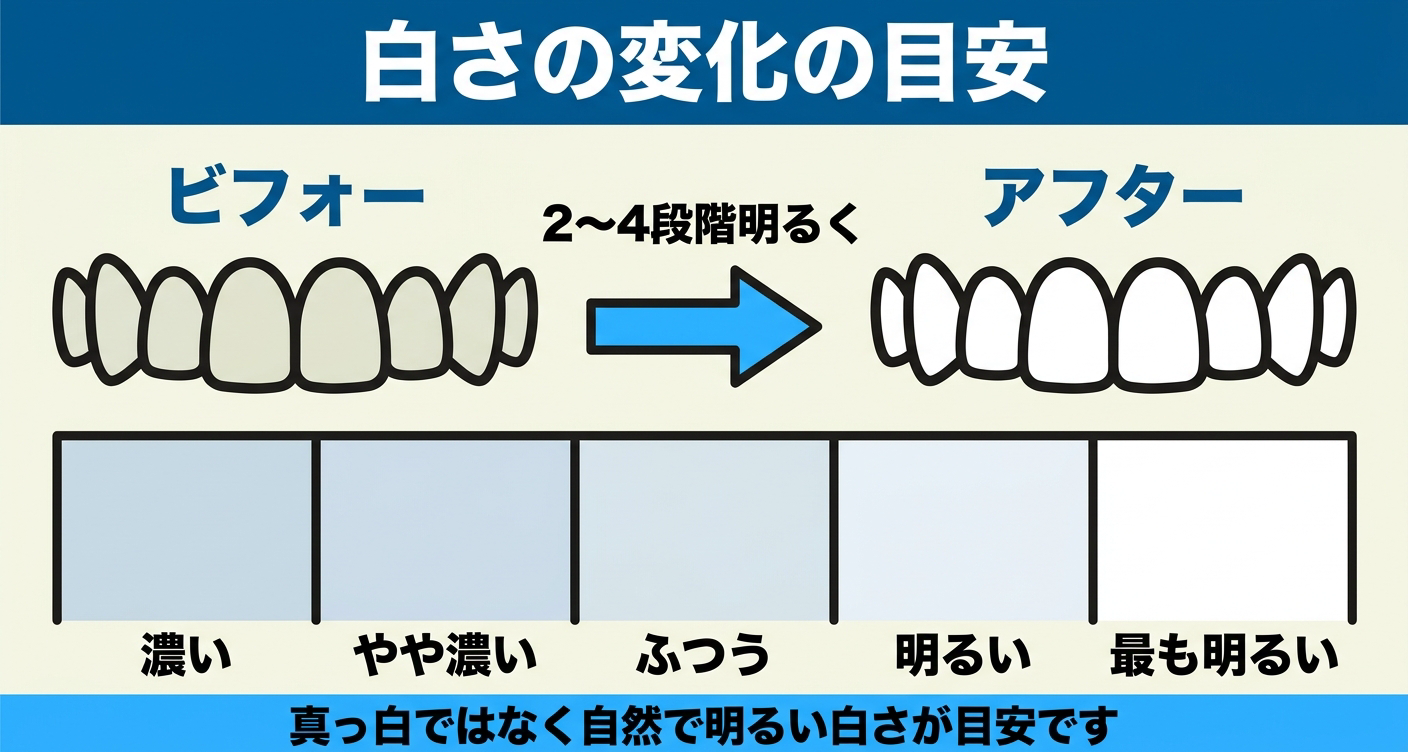ホワイトニングのビフォーアフターでの白さの変化の目安を示した図解。くすんだビフォーの歯から明るいアフターの歯へ2〜4段階明るくなる流れと、左から右へ段階的に明るくなる色見本帯を並べ、真っ白ではなく自然で明るい白さが目安であることを伝える。