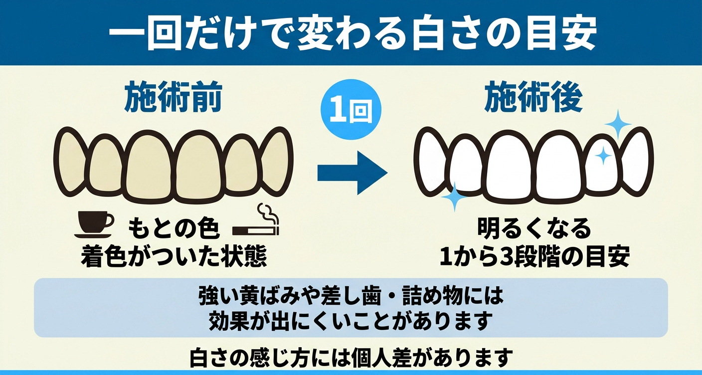 オフィスホワイトニング一回だけの白さの変化を比較した図解