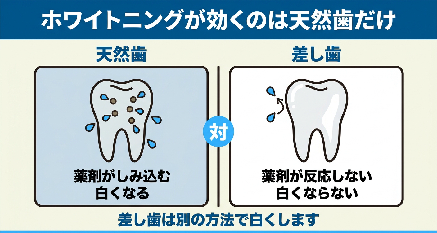 ホワイトニングの薬剤が天然歯と差し歯で異なる反応を示すことを説明する図解