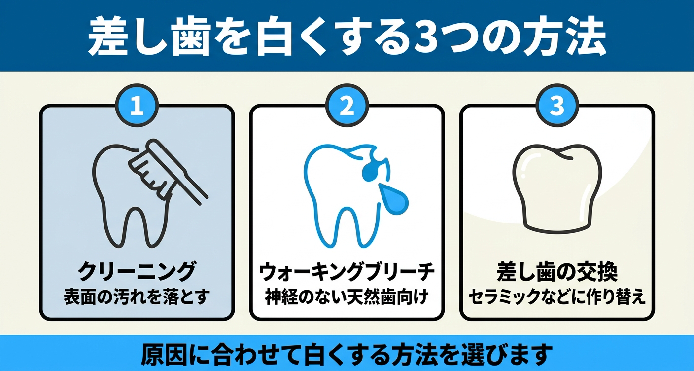 差し歯を白くする方法を整理した図解