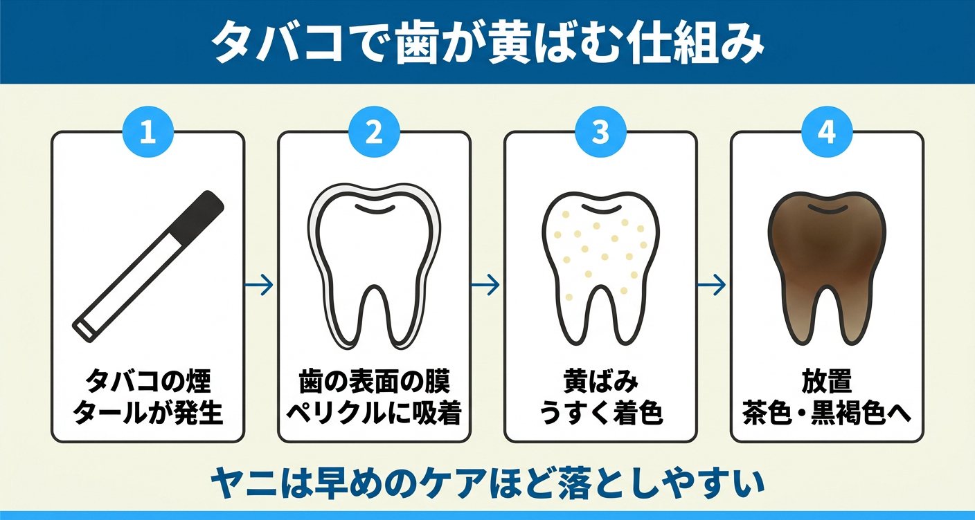 タバコで歯が黄ばむ仕組みを示した図解
