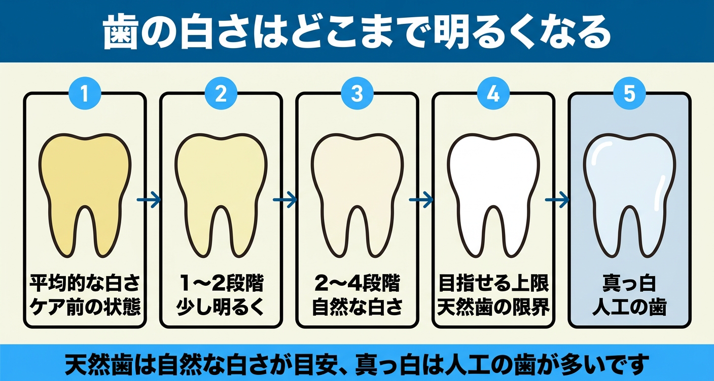 ホワイトニングで歯がどこまで白くなるかを示した図解