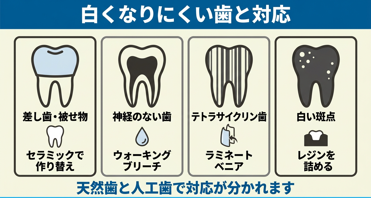 ホワイトニングで白くなりにくい歯と修復治療を整理した図解