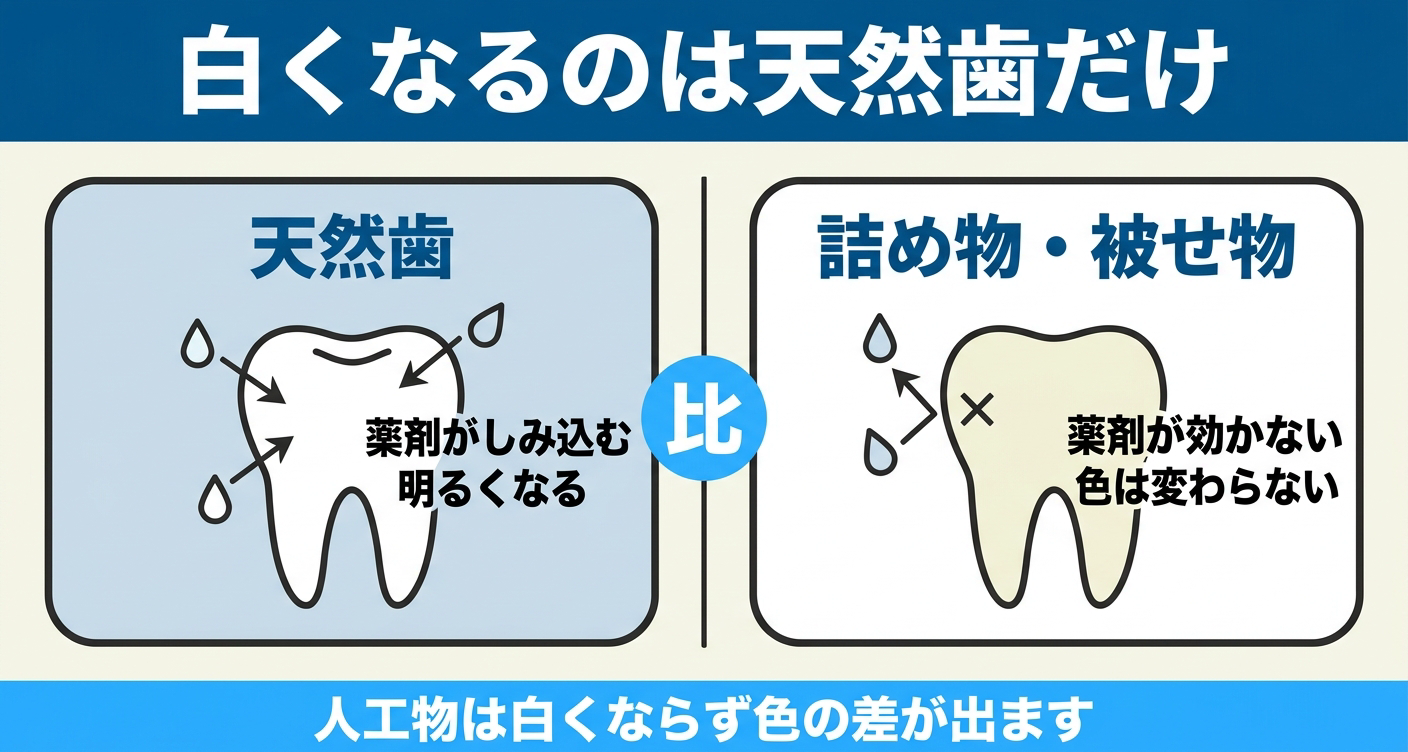 ホワイトニングで白くなるのは天然歯だけで、詰め物や被せ物などの人工物は薬剤が効かず色が変わらないことを左右の対比で示した図解。天然歯は薬剤がしみ込んで明るくなる一方、人工物は色が変わらず色の差が出ることを伝える。