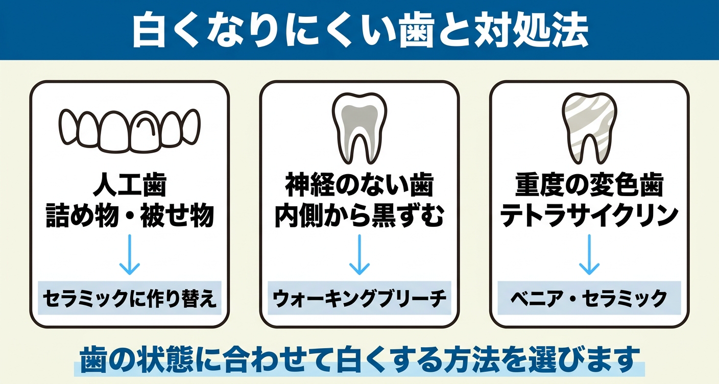 ホワイトニングで白くなりにくい歯と対処法を3パネルで対比した図解。詰め物・被せ物などの人工歯はセラミックへの作り替え、神経のない歯はウォーキングブリーチ、テトラサイクリン変色歯はベニアやセラミックと、歯の状態で方法を選ぶことを示す。