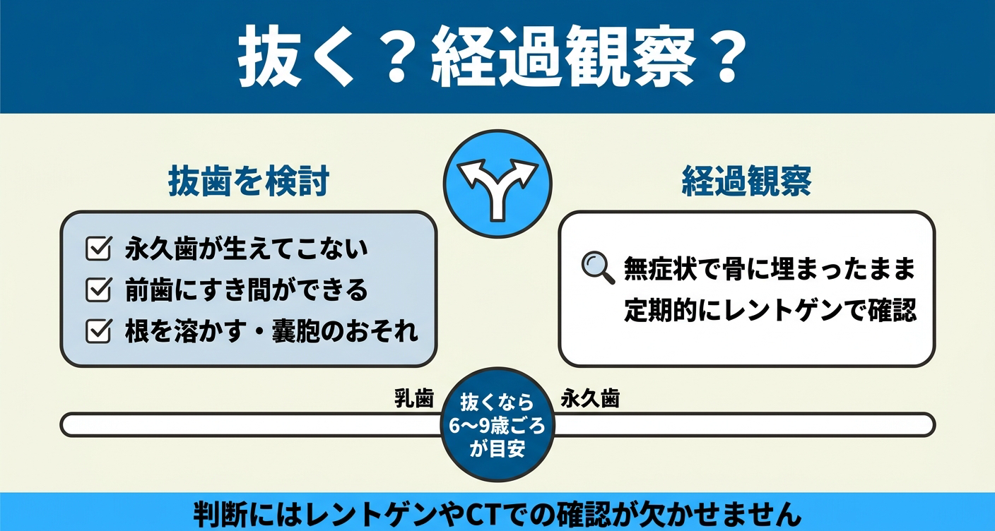 子供の過剰歯を抜くか経過観察するかの判断基準と抜歯時期を示した図解。永久歯が生えてこない・すき間ができる・根に影響するおそれがあれば抜歯を検討、無症状で埋まったままなら経過観察とし、抜くなら6〜9歳ごろが目安であることを伝える。