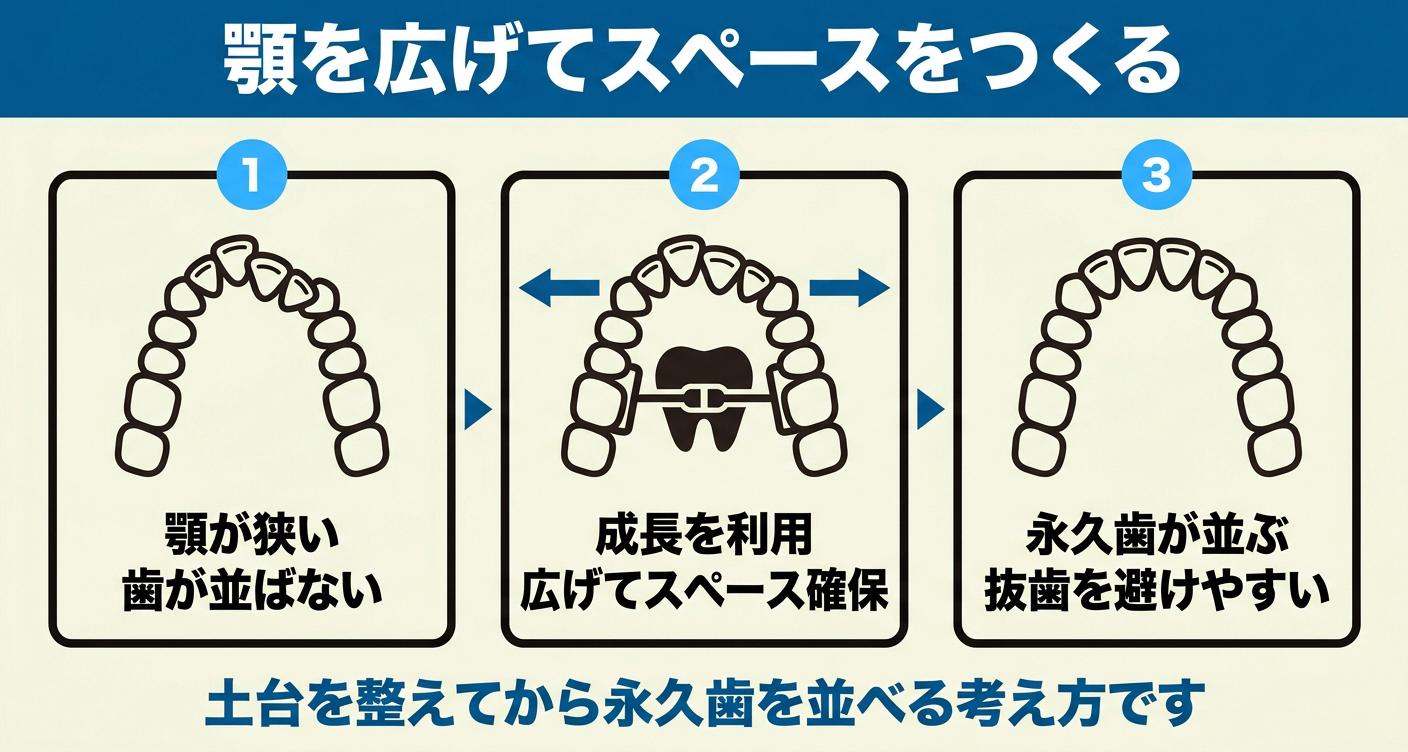 小児矯正で顎を広げる目的と仕組みを3段階で示した図解。顎が狭く歯が並ぶスペースが不足している状態から、成長を利用して歯列を左右に広げ、永久歯が並びやすい環境づくりを目指す流れを、上から見た歯のならびの抽象シルエットで整理している。