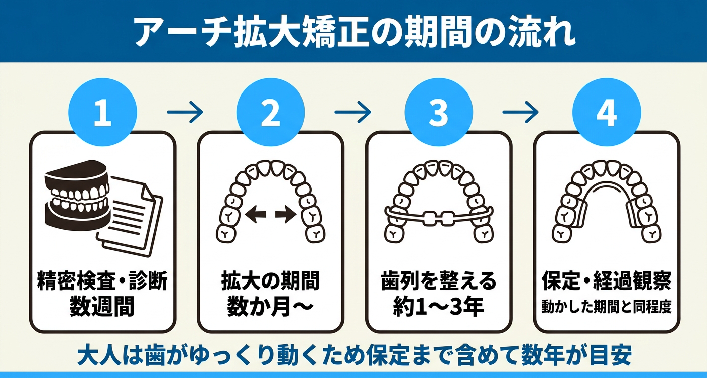 大人のアーチ拡大矯正の期間の流れを4段階で示した図解。精密検査・診断、数か月の拡大期間、約1〜3年かけた歯列を整える期間、動かした期間と同程度の保定・経過観察を矢印でつなぎ、大人は歯がゆっくり動くため保定まで含めて数年が目安であることを伝える。