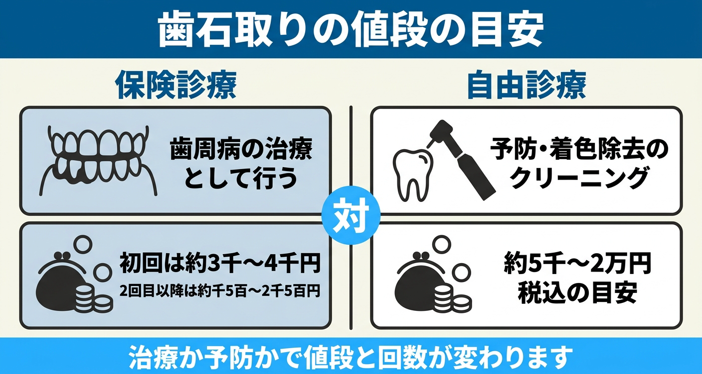 歯石取りの値段を保険診療と自由診療で対比した図解。保険は歯周病治療として行い初回約3千〜4千円・2回目以降約千5百〜2千5百円、自費は予防や着色除去のクリーニングで約5千〜2万円(税込)と並べ、治療か予防かで値段と回数が変わることを示す。