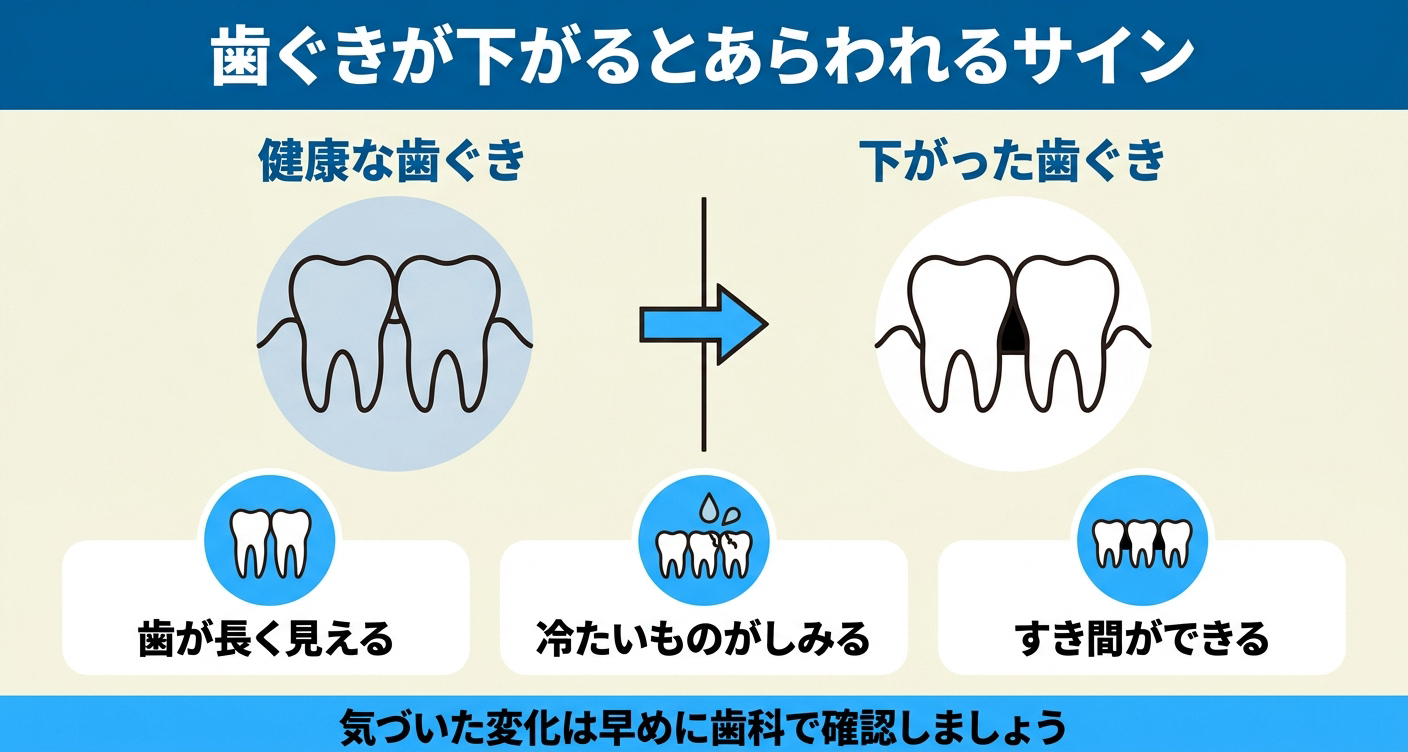 歯茎の後退(歯肉退縮)で起こる見た目と症状のサインを示した図解。健康な歯ぐきと下がった歯ぐきを対比し、歯が長く見える・冷たいものがしみる・歯と歯の間にすき間ができるという3つのサインを並べ、気づいた変化は早めに歯科で確認するよう促す。