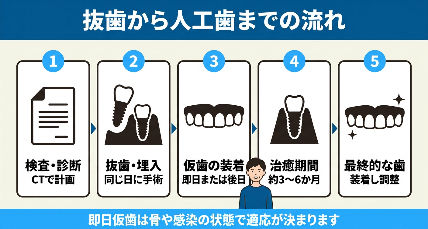 オールオン4の抜歯から人工歯装着までの流れを整理した図解