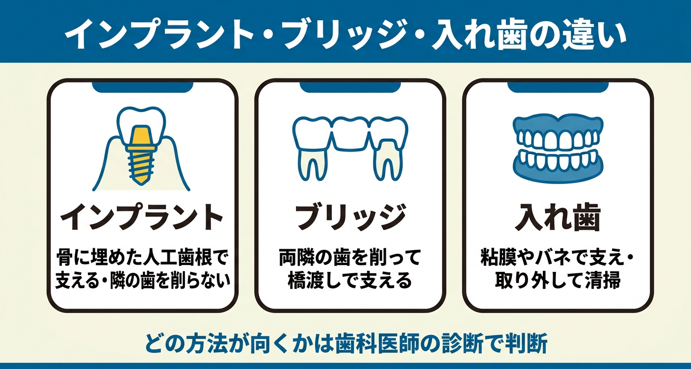 インプラント・ブリッジ・入れ歯の違いを3カードで整理した図解。支え方や周囲の歯への影響の違いを視覚的に示し、どの方法が向いているかは歯科医師の診断で判断することを促します。