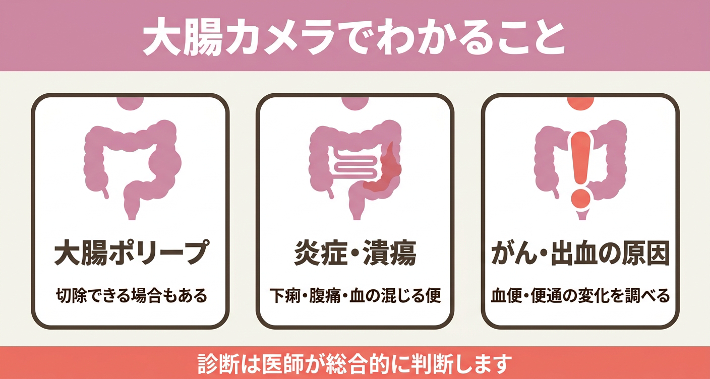 大腸カメラで確認できる主な粘膜変化の図