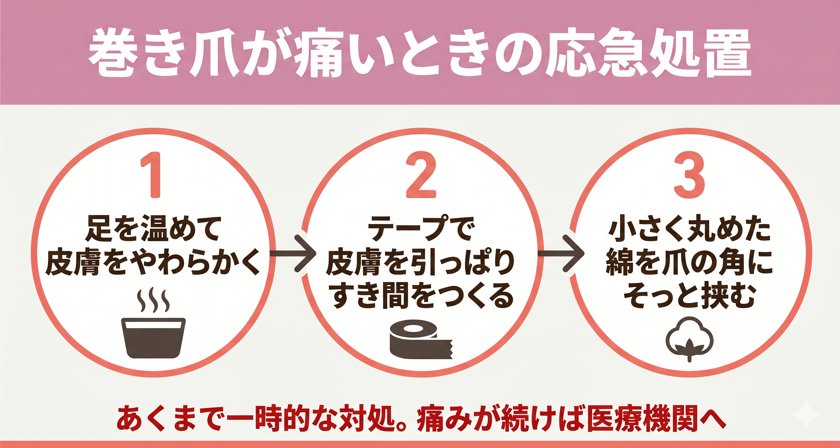 巻き爪の応急処置の手順