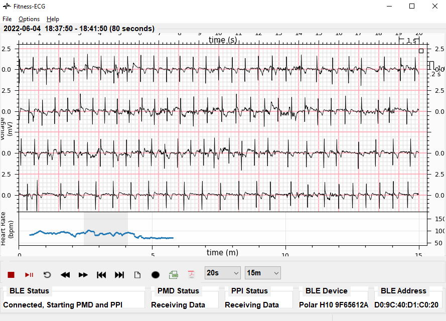 Sample ECG