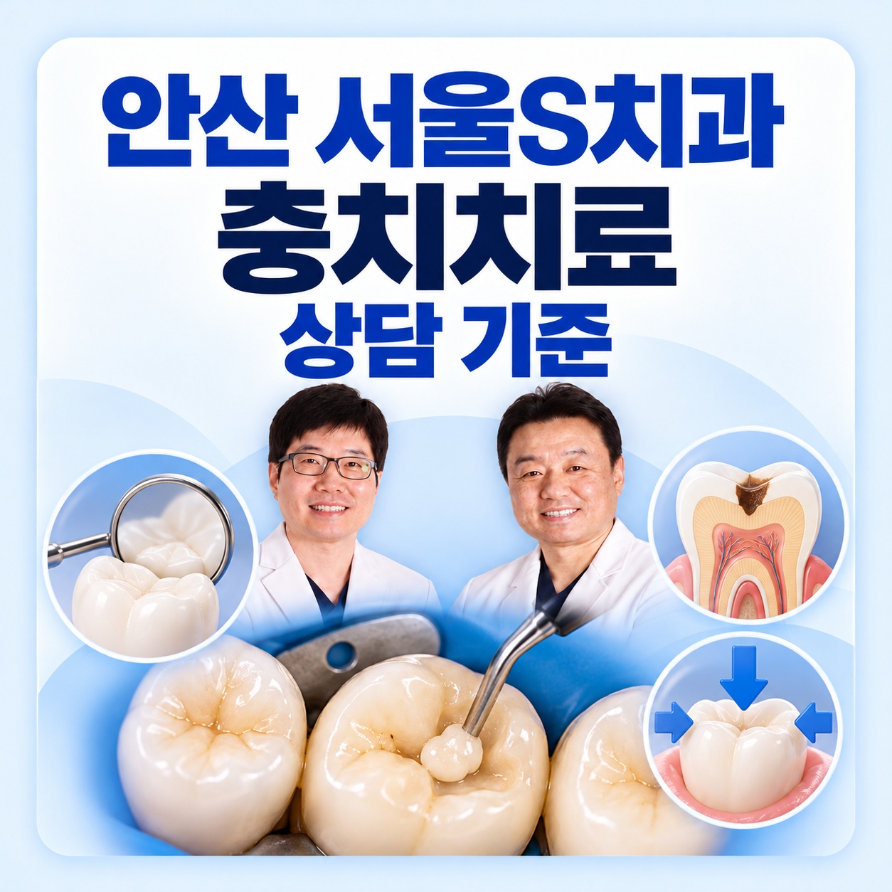 안산 서울S치과 충치치료 검사와 재료 선택 상담 체크리스트