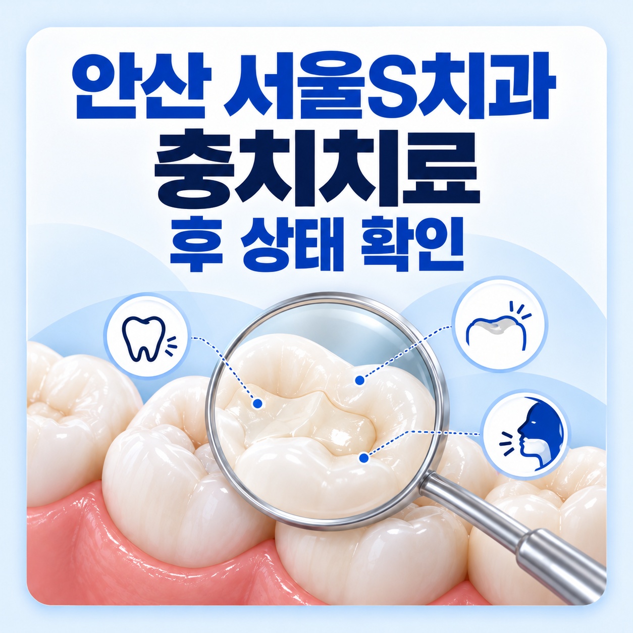 안산 서울S치과 충치치료 후 수복물 상태와 검진 안내