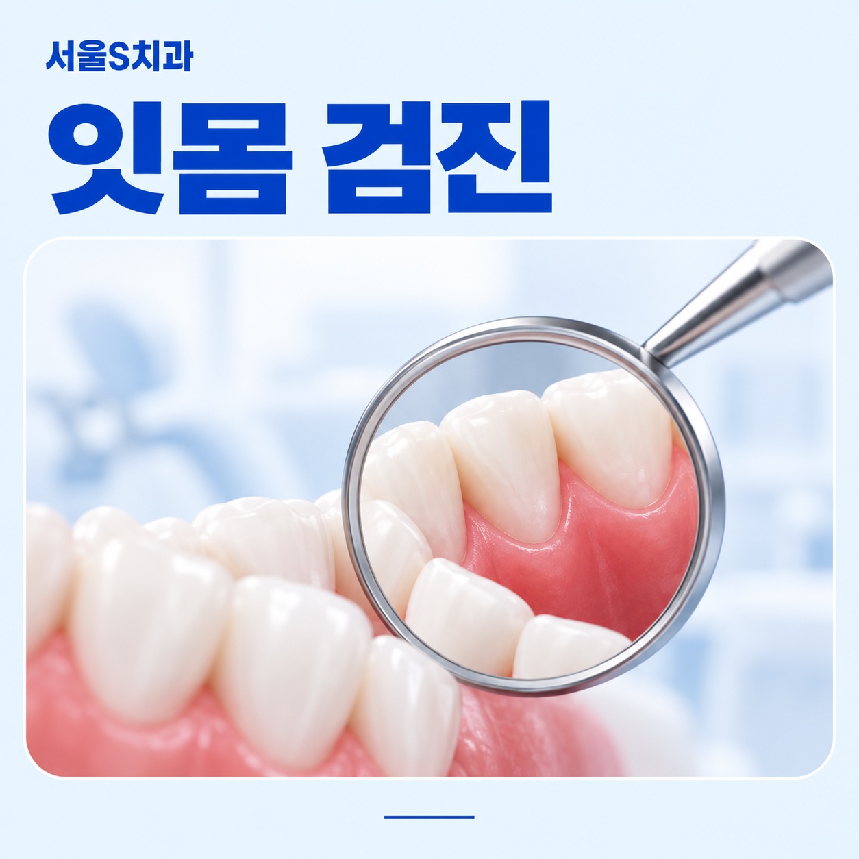 안산 고잔동 서울S치과 잇몸 검진 이미지