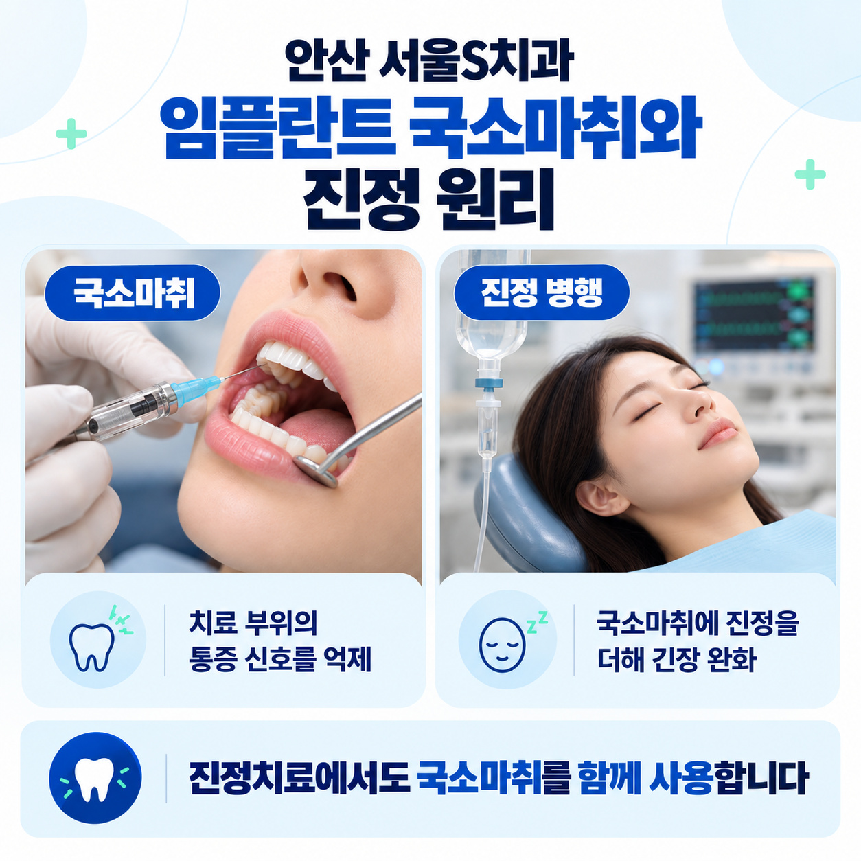 안산 서울S치과 임플란트 국소마취 통증 신호 억제와 진정 역할