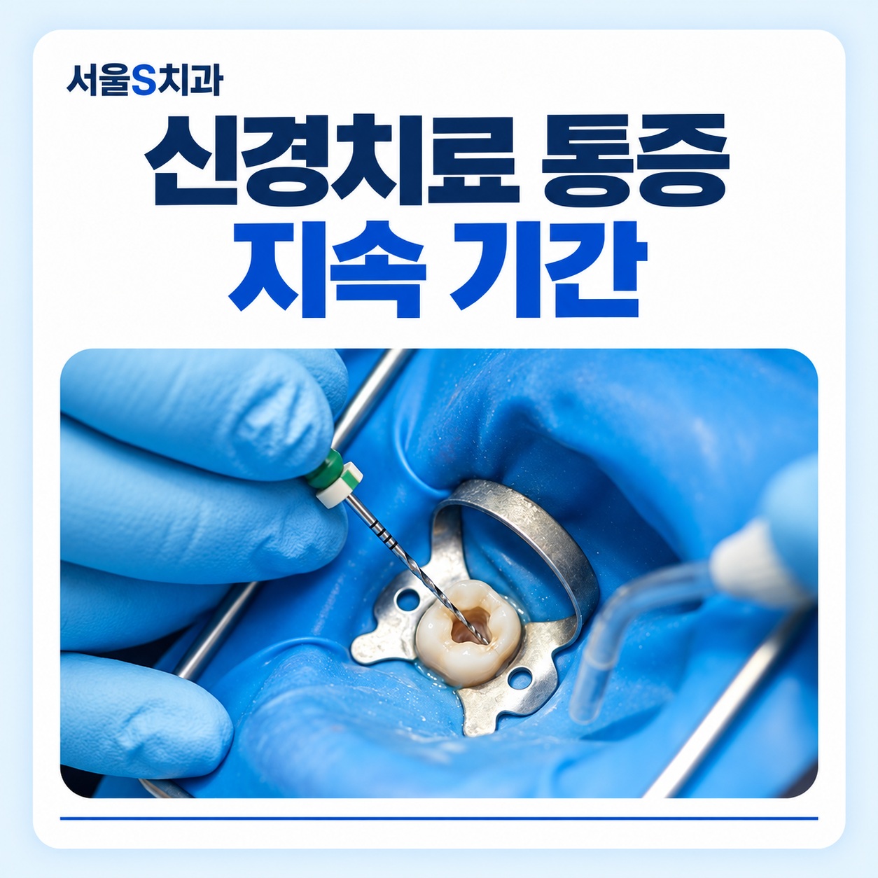 신경치료 통증 지속 기간 안산 고잔동 치과 신경치료 통증 지속 기간 안내