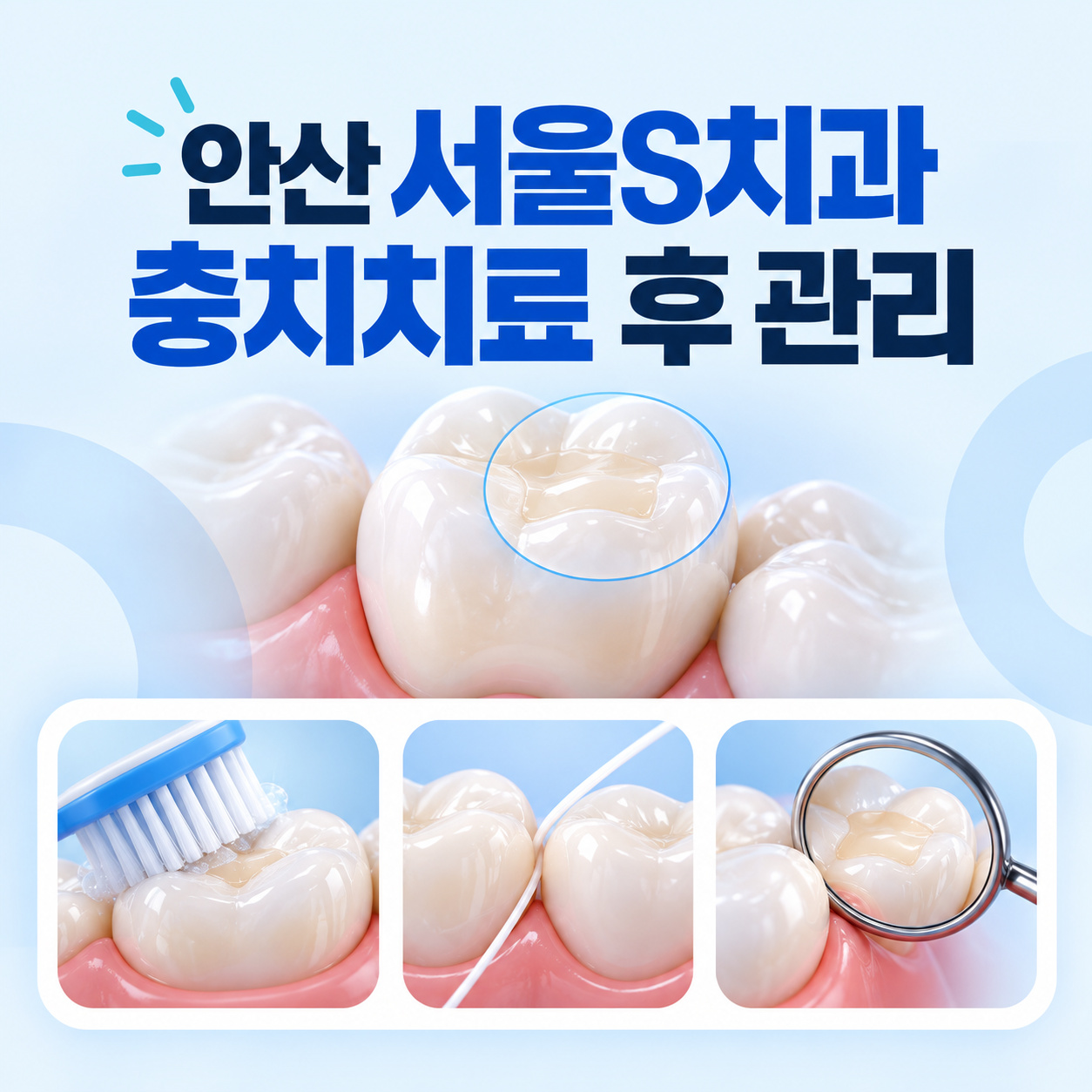 안산 고잔동 서울S치과 충치치료 후 칫솔질 치간관리와 정기 검진 안내