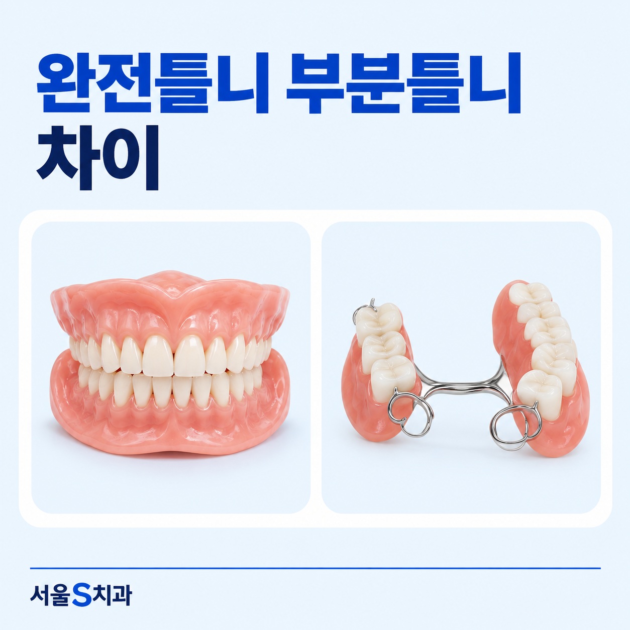 안산 중앙동 치과 완전틀니 부분틀니 비교