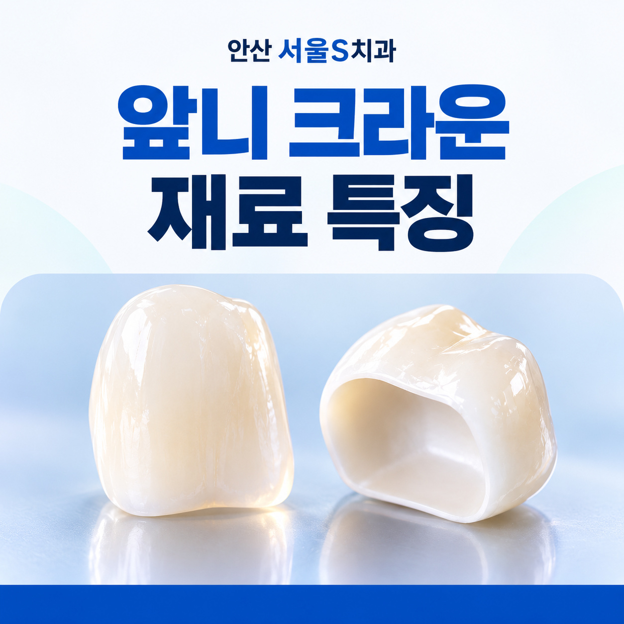 안산 서울S치과 앞니 크라운 재료 특징 안산 서울S치과 앞니 크라운 올세라믹과 색감 비교