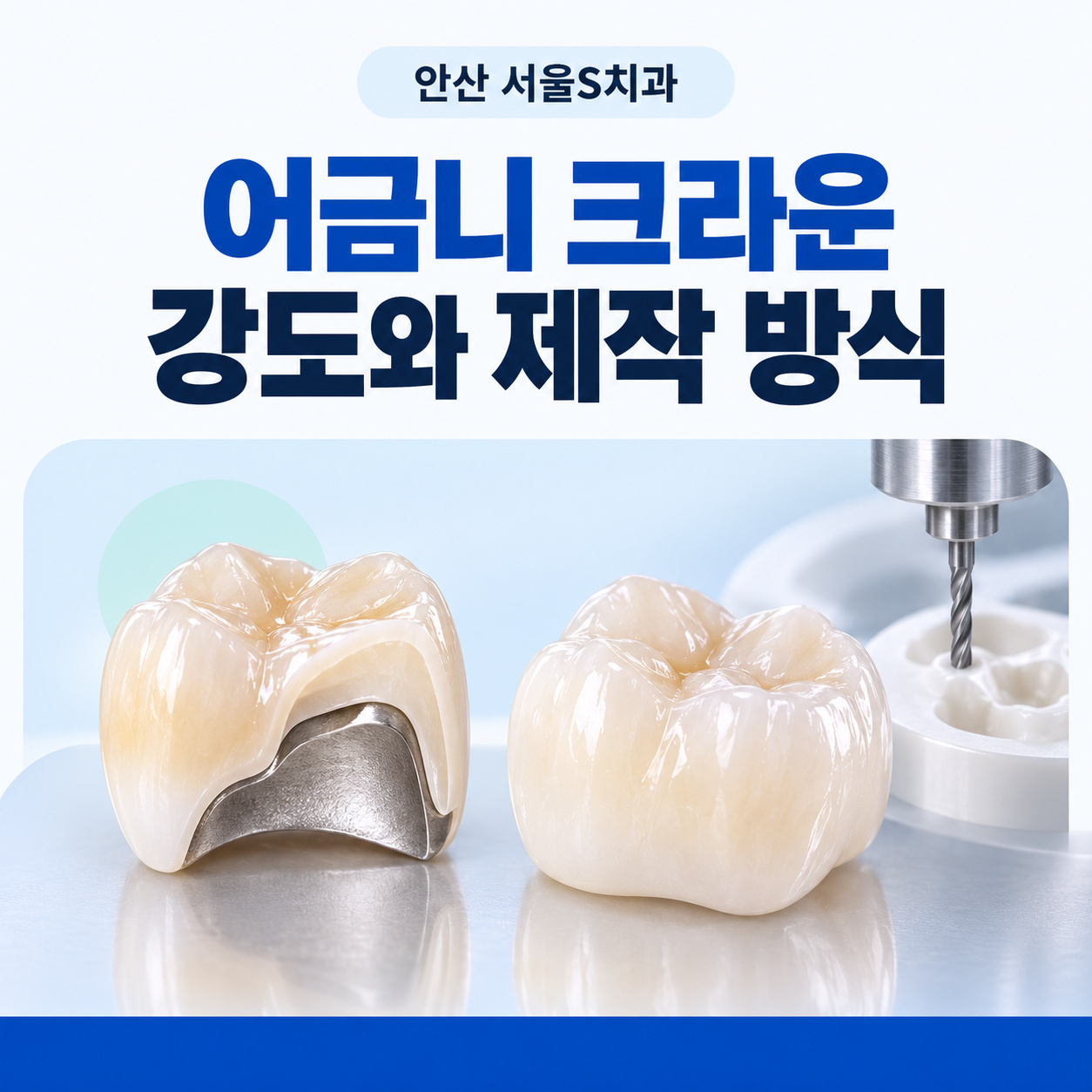 안산 서울S치과 어금니 크라운 강도와 제작 방식 안산 서울S치과 어금니 크라운 PFM과 지르코니아 특징