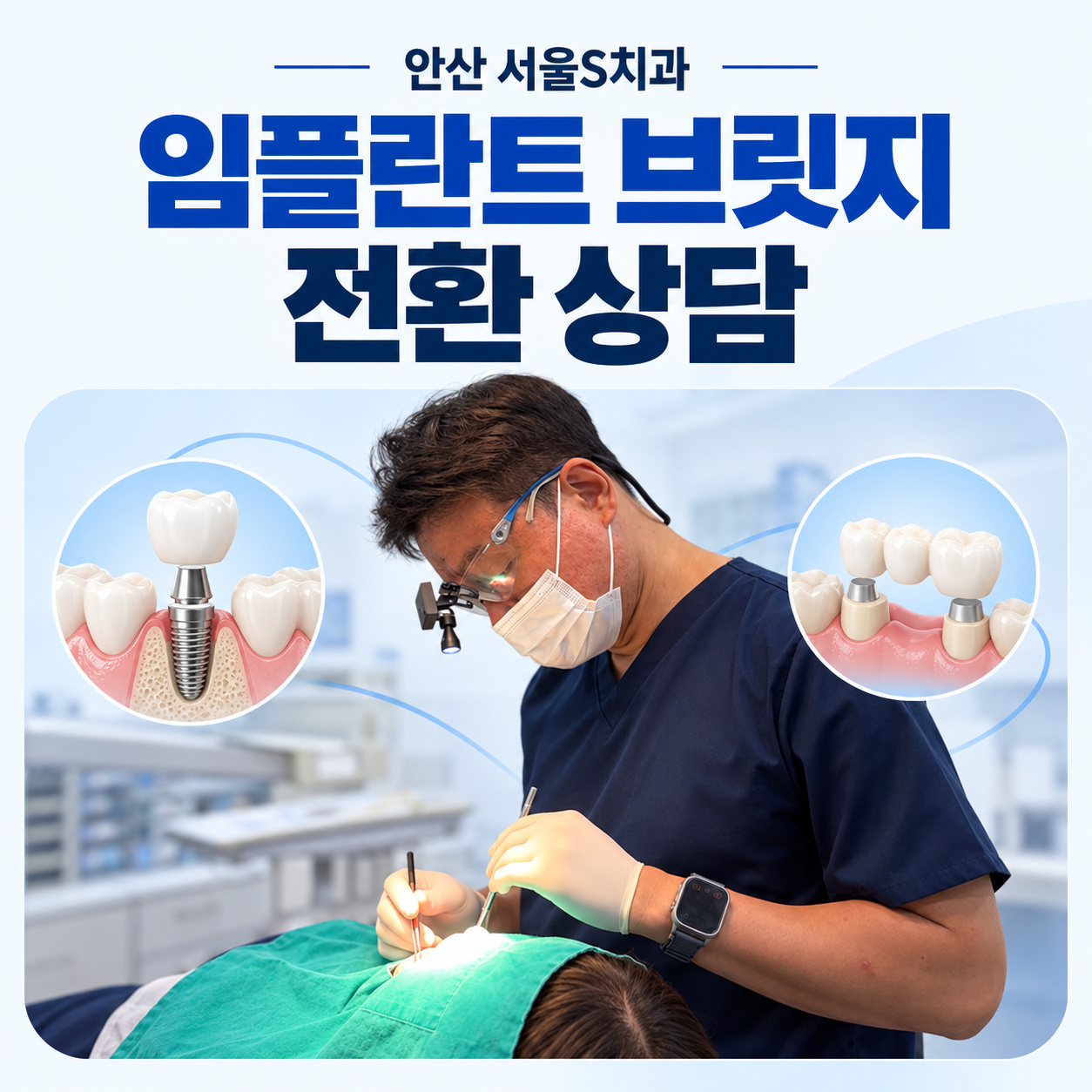 안산 서울S치과 브릿지에서 임플란트로 변경 전 확인 사항