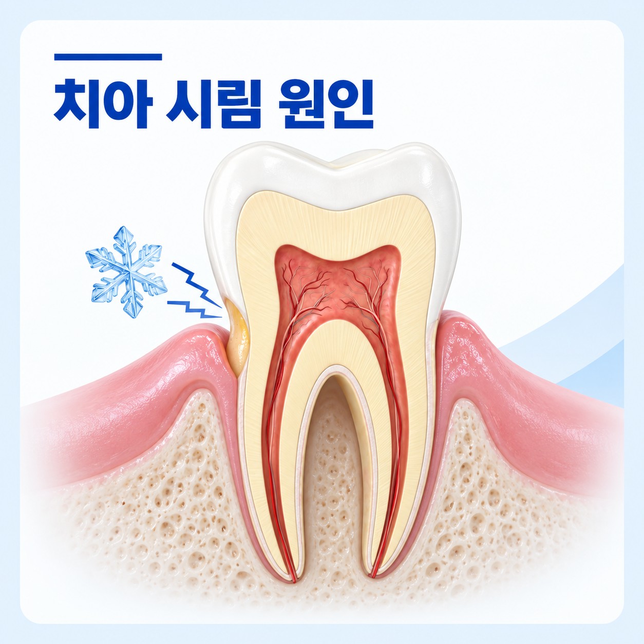안산 서울S치과 치아 시림 원인 상담