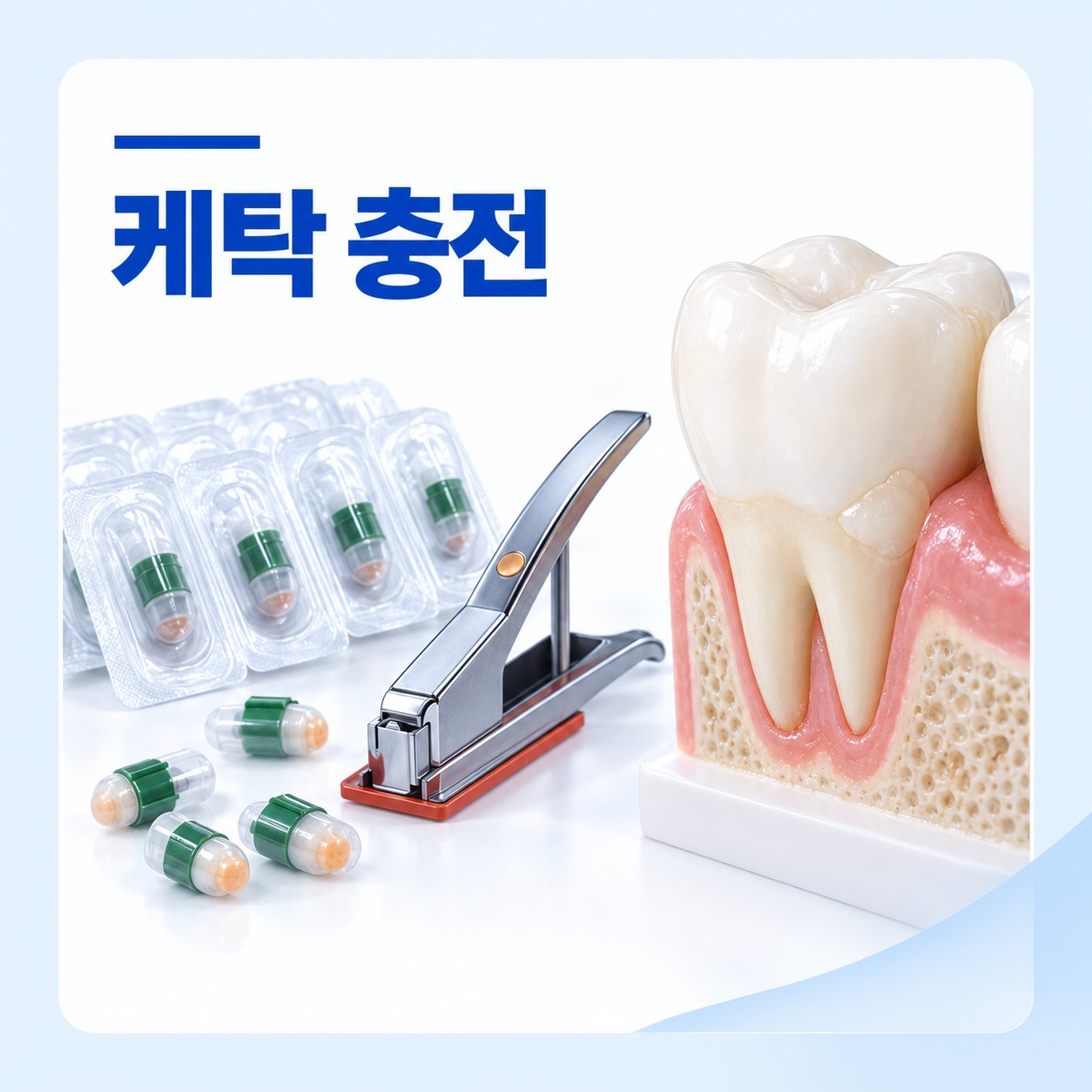 안산 서울S치과 케탁 충전 치료 과정