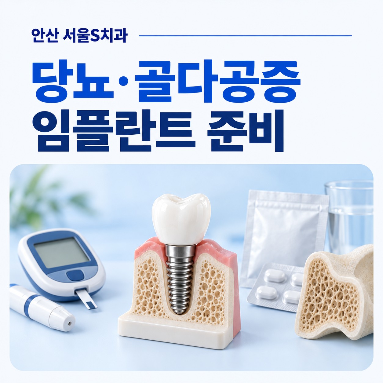안산 중앙동 서울S치과 당뇨병·골다공증 환자 임플란트 핵심 요약