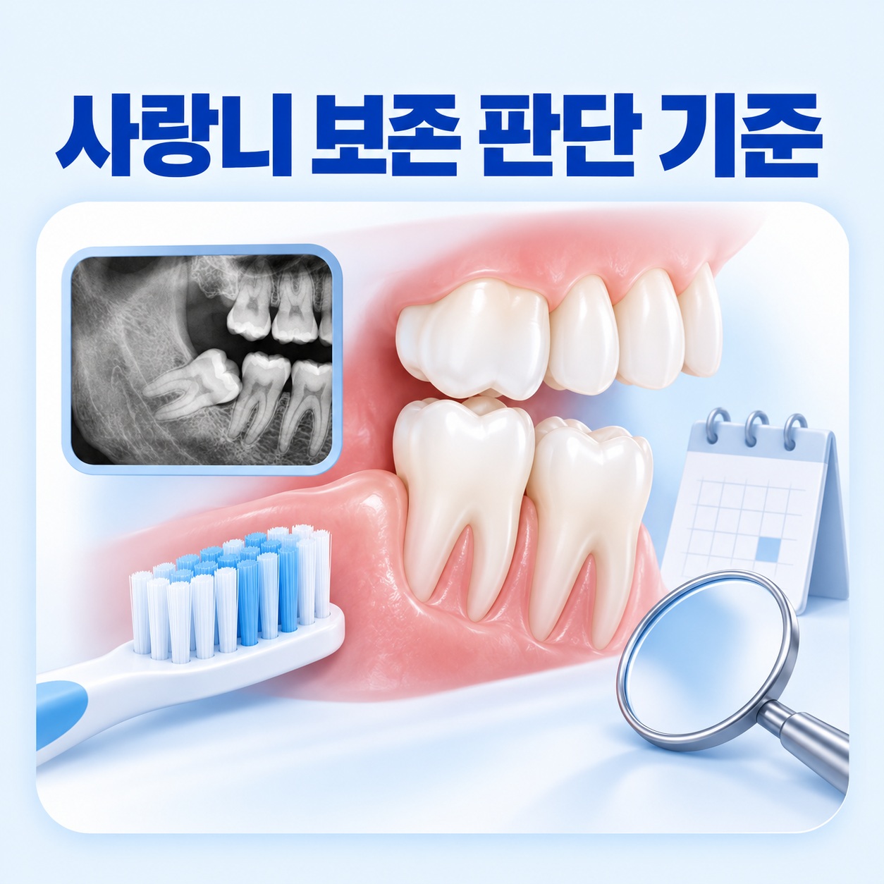 안산 서울S치과 사랑니 보존 여부 판단 기준