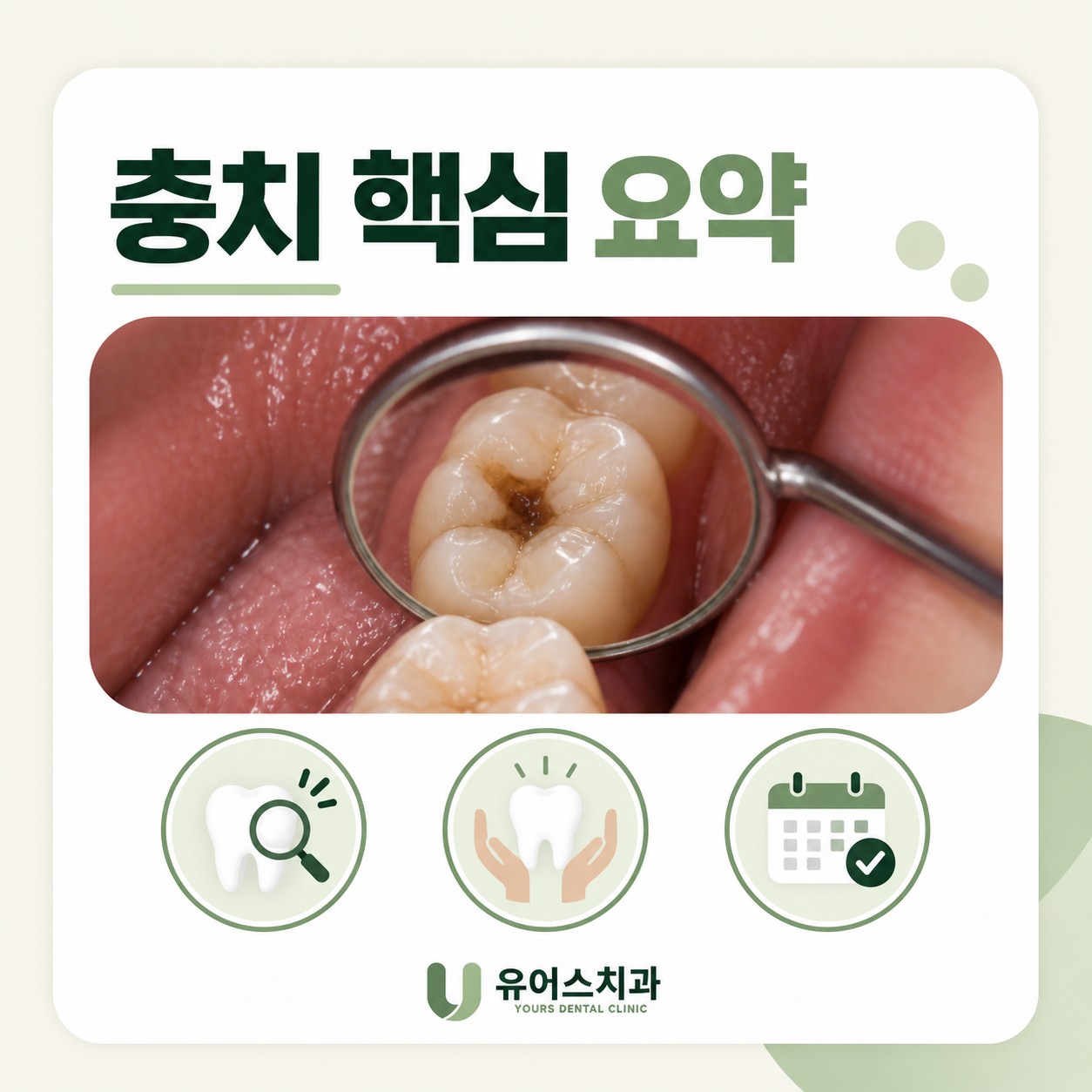 부천시청역 유어스치과 충치 진행 핵심 요약