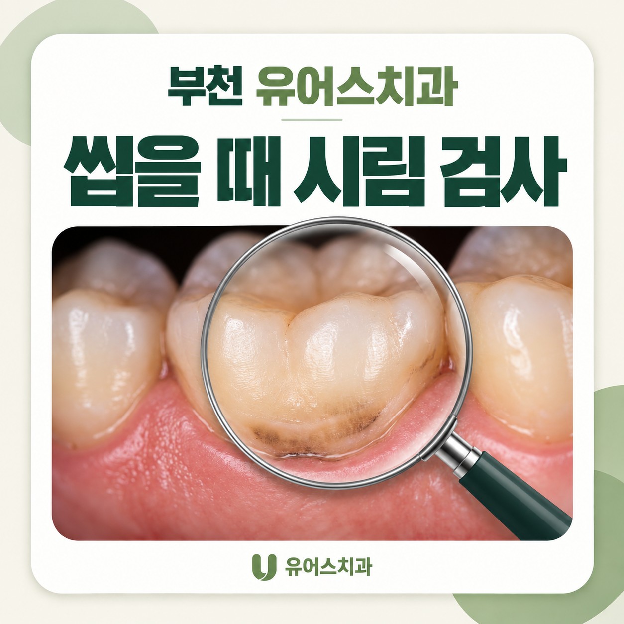 부천시청역 유어스치과의원 치아 크랙과 충치 구강검진