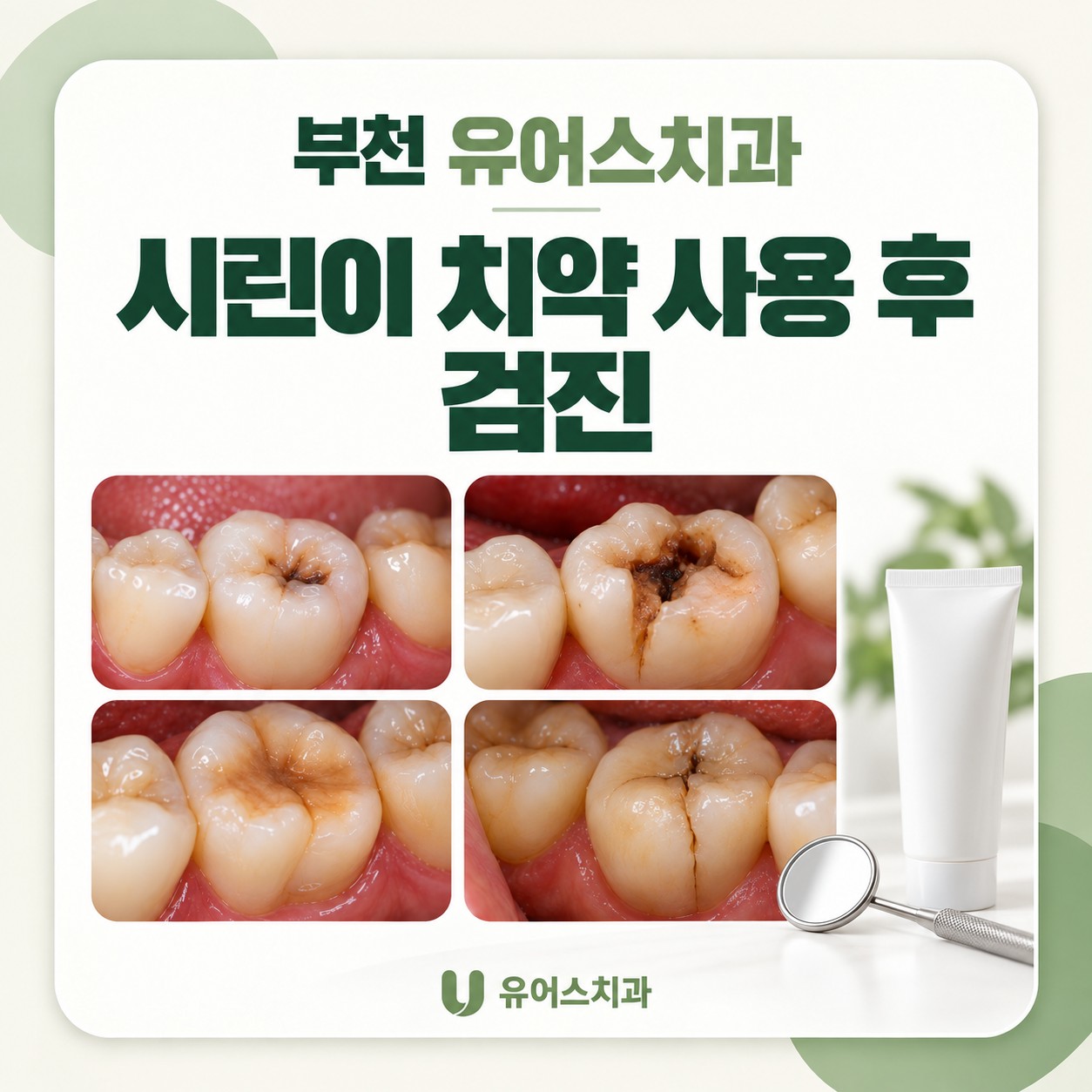 부천시청역 유어스치과의원 지속되는 시린이 구강검진 안내