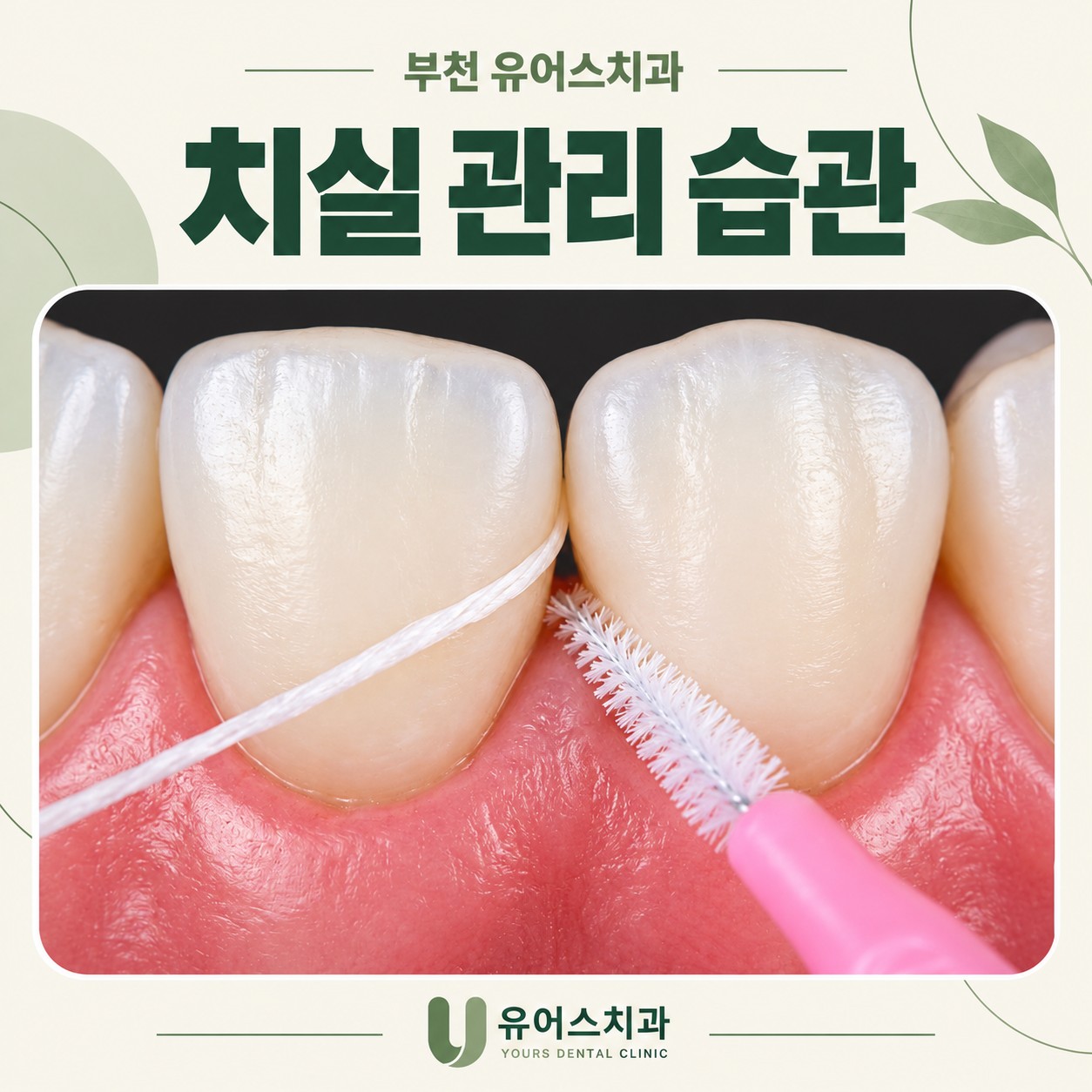 부천시청역 유어스치과 치실 출혈과 매일 구강관리 안내