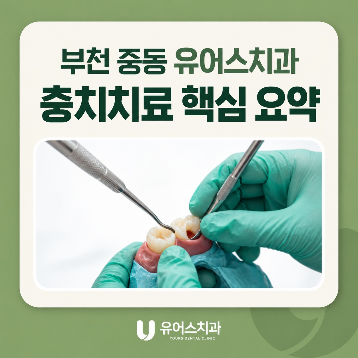 부천 중동 유어스치과 충치치료 선택 기준과 남은 치아 상태