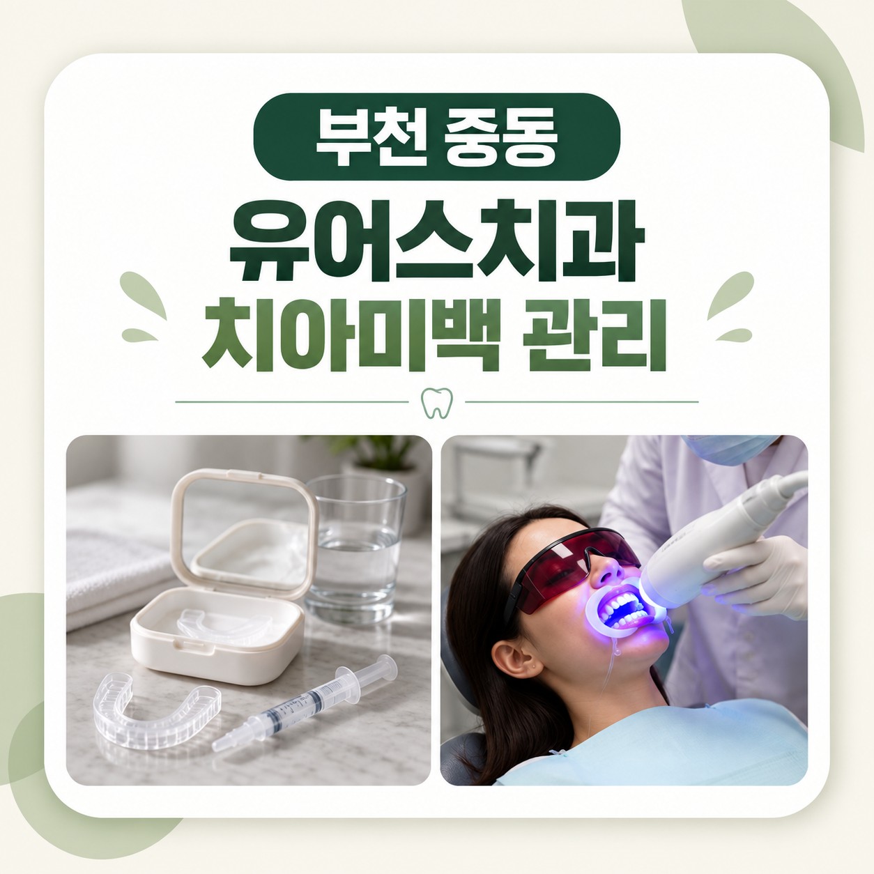 부천 중동 유어스치과 치아미백 후 시림과 트레이 착용 주의사항