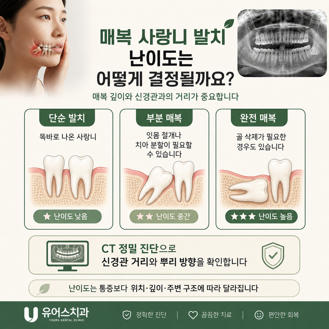 부천 중동 치과 사랑니발치 안내