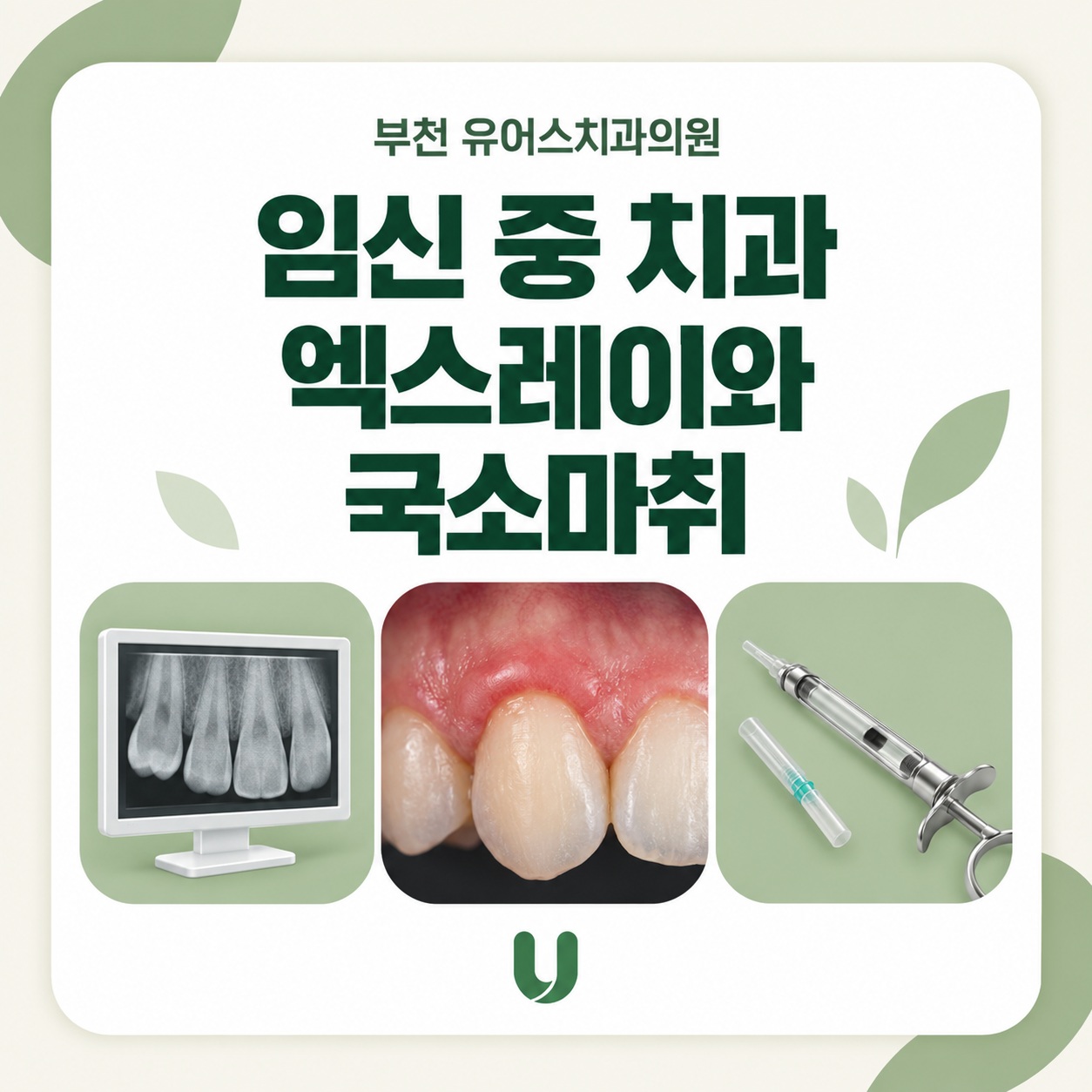 부천시청역 유어스치과의원 임신 중 치과 엑스레이와 국소마취 안내
