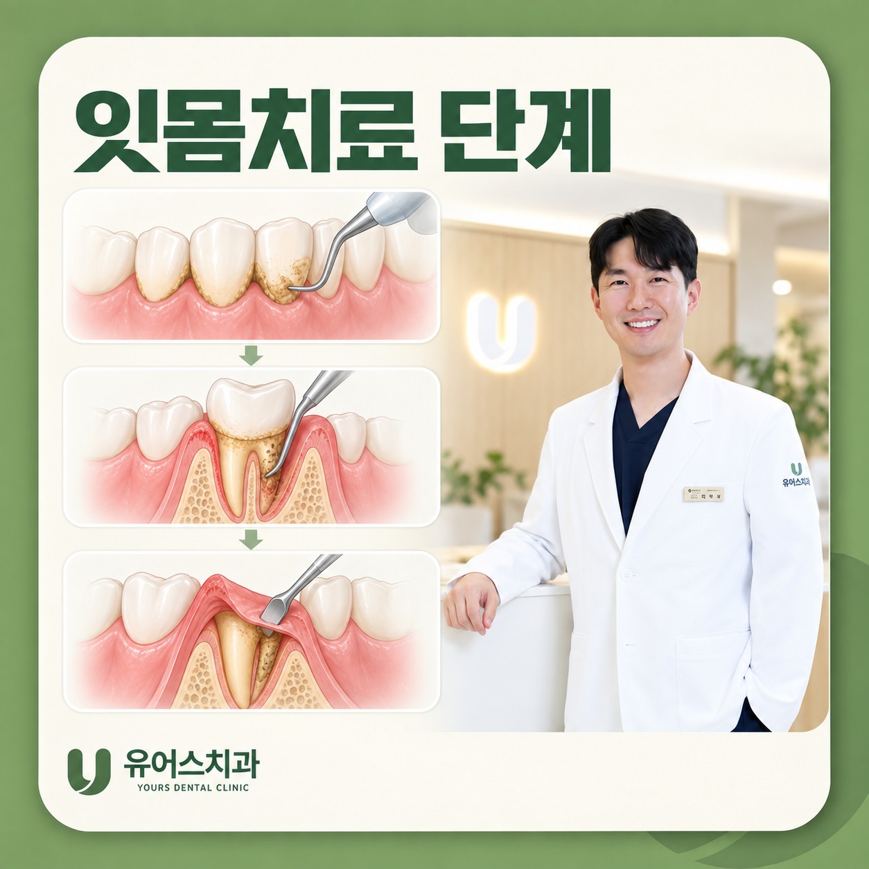 부천 유어스치과 잇몸치료 단계별 진행 과정