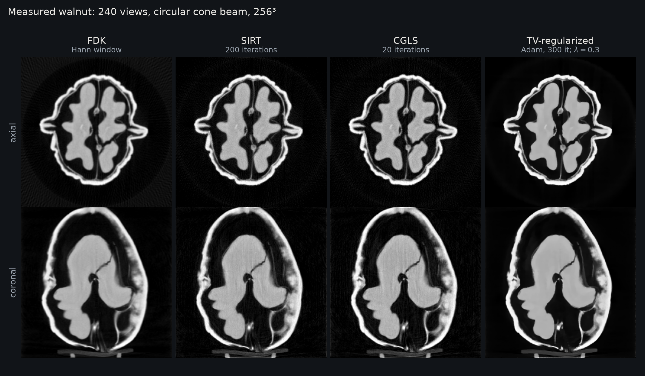 Measured walnut: FDK, SIRT, CGLS and TV reconstructions