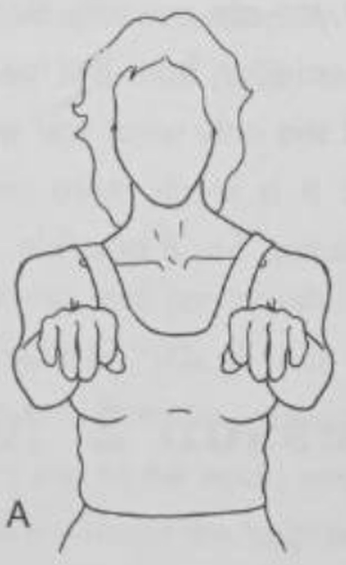 figure 10-6a