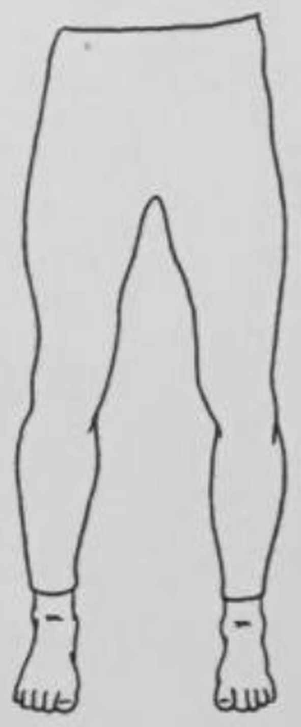 figure 12-1