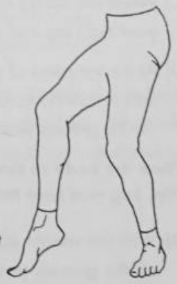 figure 12-12