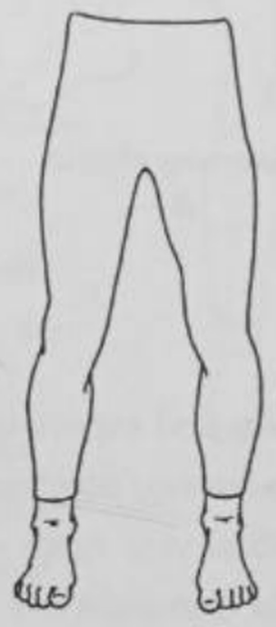 figure 12-13